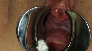 Peehole Cigarette torture. BDSM Speculum Stretched Female Urethral Sounding