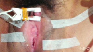 クリトリス 電気責め 吸引