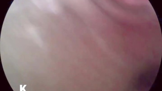 [Ultra-compact camera] I explored the inside of the vagina with Cusco.