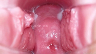 Cervix Display and Speculum Play