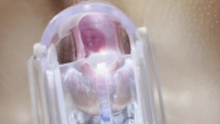 Inserting vaginal speculum and observing Japanese pussy (Amateur)