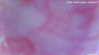 Cells moving inside pussy vessels!