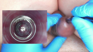 I put an endoscope in a 10mm test tube and observed the inside of the urethra.