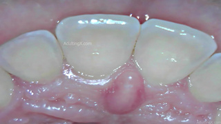 Vore All The Way Down - Teaser