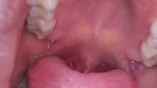 Vore same size- My doctor eat me