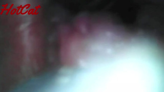 Endoscopic ♥vaginal observation